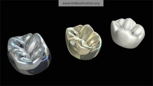 or-métal-céramique-dentaire-couronne-dentiste-gatineau