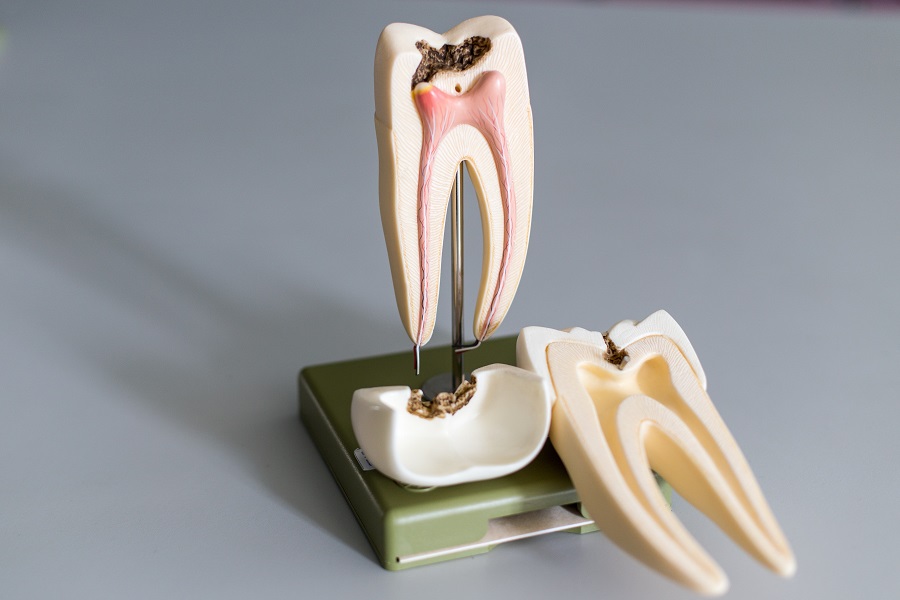L'endodontie